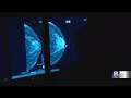 URMC participating in new international study