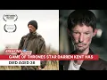 Game of Thrones star Darren Kent has died aged 36
