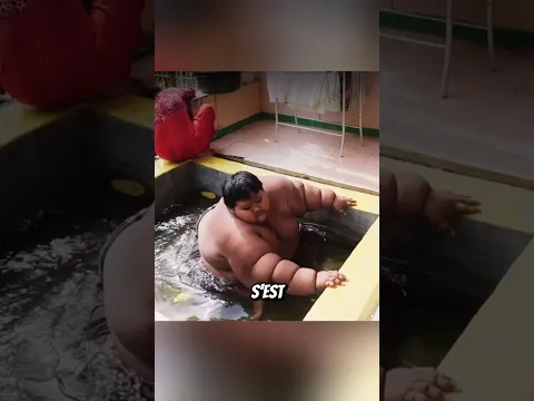 Voici quelques-uns des enfants les plus rares au monde — et le dernier est incroyable 😨