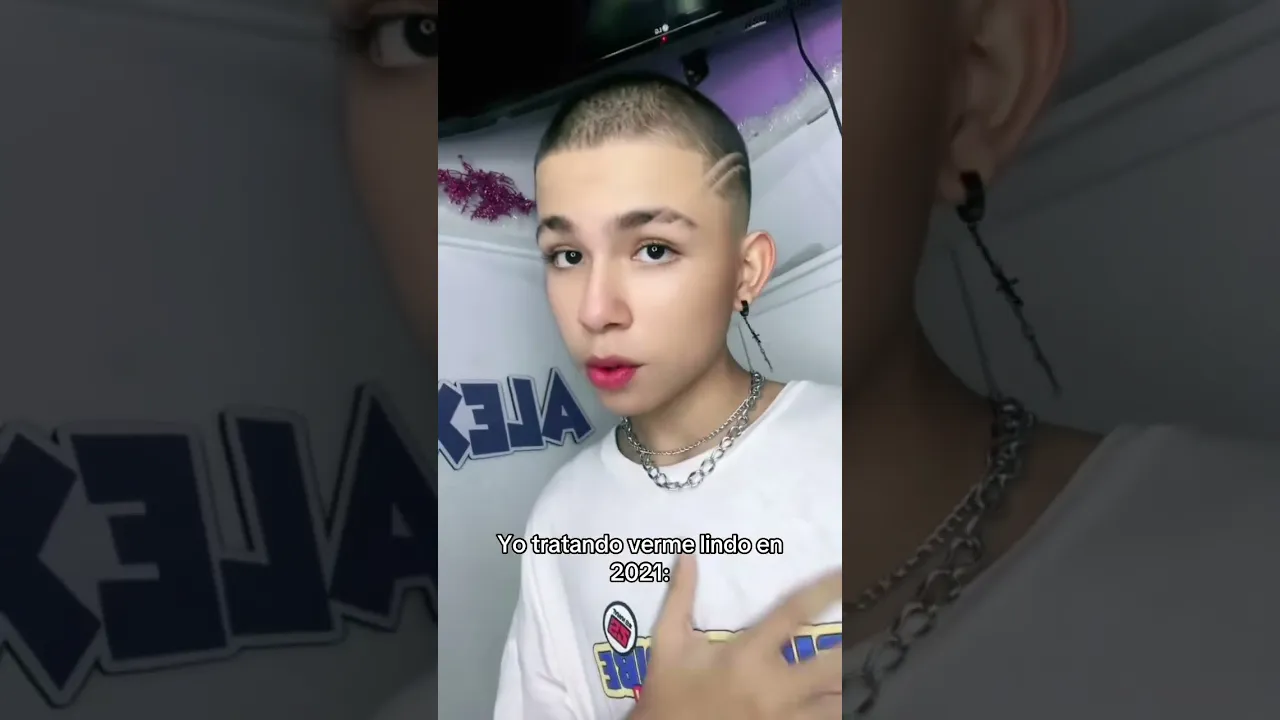 Antes vs Después