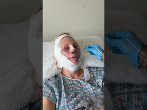My Moms POST SURGERY RECOVERY Transformation