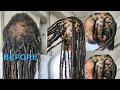 HOW TO COOLEST LOC TRANSFORMATION REPLACING BALD SPOTS WITH NATURAL LOCS