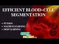 Python Image Processing Project - Blood-Cell Segmentation for Hematological Disorder