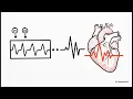 Don t Miss These MIs Right Ventricular Posterior MI Explained ECG Made Easy