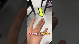 أصاب ع ه ما بتنفصل عن ب عض 