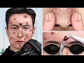 Download Lagu [ASMR Animation] Skin Care for Front Man | Blackheads Removal