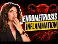 Endometriosis symptoms and signs of hidden inflammation Doctor Explains