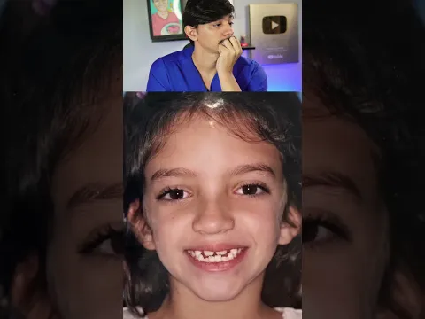 Ela tem 21 parafusos no rosto!