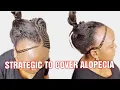 COVERING ALOPECIA WITH FEED IN BRAIDS HOW TO BRAIDS ON ALOPECIA CLIENT BRAIDS FOR THIN HAIR