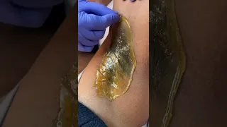 Satisfying Underarm Waxing Using Hard Wax  Satisfying Underarm Waxing Using Hard Wax