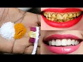 Download Lagu How Did I Whiten My Teeth at Home in 3 days Teeth Whitening Tips