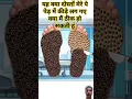 Download Lagu 😱यह क्या दोस्तों मेरे पैर में कीड़े लग गए हैं क्या मैं ठीक हो सकती हूं #animation #trending #doctor