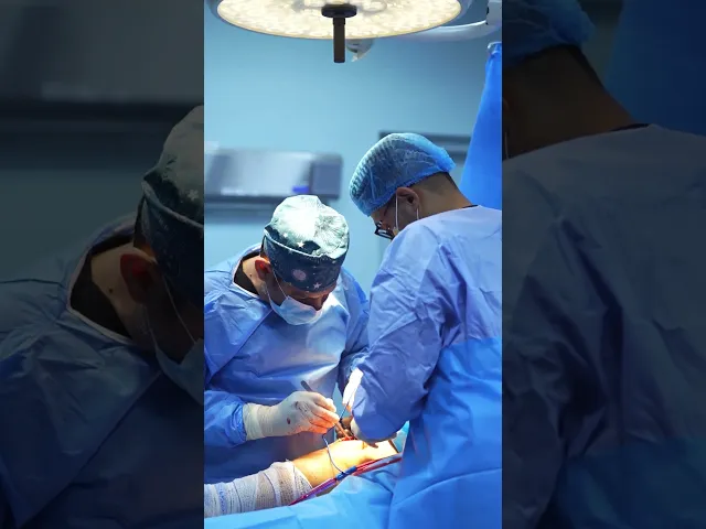 ⁣إجراء عمليتين لتبديل المفصل الكامل◇ الدكتور محمد باقر عباس