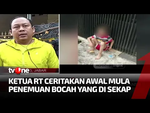 Kondisi Terkini Bocah Lima Tahun yang Disekap dan Dirantai
