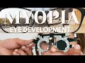 Myopia and Eye Development
