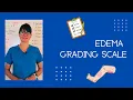 Edema Grading Scale