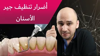 أضرار تنظيف جير الأسنان عند الطبيب الطريقة الصحيحة لازالة جير الأسنان 