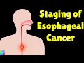 Lagu Esophageal Cancer Staging | TNM Staging for Esophageal Cancer | AJCC Staging System