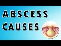 Abscess Symptoms Treatment and Causes