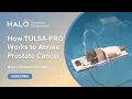 How Does the TULSA Procedure Prostate Cancer Treatment Work Dr Karamanian Explains 3D Simulation