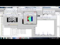 Breast cancer detection in thermal imaging using SVM classifier