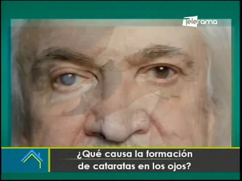 ¿Qué causa la formación de cataratas en los ojos?