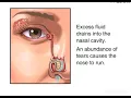 Blinking Reflex