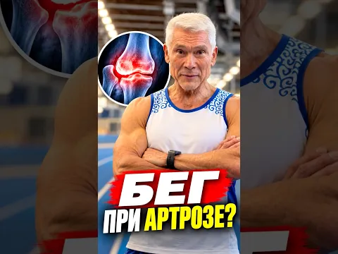 Можно ли бегать при артрозе?