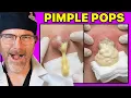 Plastic Surgeon Reacts to the BIGGEST Pimple Pops on the Internet - Safe or Seriously Risky