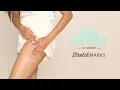 How To Reduce Stretch Marks DIY Home Remedies
