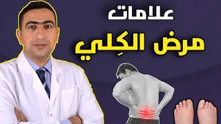 علامات مرض الكلى المبكرة ٨ علامات تحذيرية تدل على أن الكلى لا تعمل بشكل صحيح 