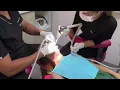 My Dental Appointment Fixing a Lost Filling During My Invisalign Journey