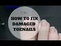 How to fix damaged bad nails