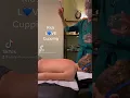 Kids love Cupping