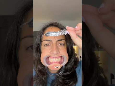 Dientes de rapera 😅 #fail #random
