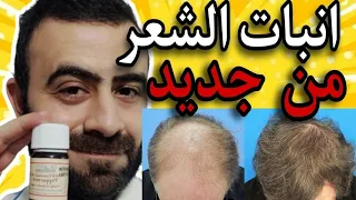 التركيبة الثلاثية المعجزة لعلاج الصلع الوراثي بقوة زيت النعناع و اكليل الجبل و الافندر 2022 