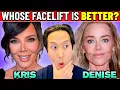 Plastic Surgeon Whose Facelift is Better Kris Jenner or Denise Richards
