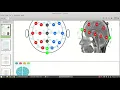 Clasificador EEG signals