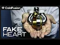 Download Lagu New Artificial Heart Saved a Life