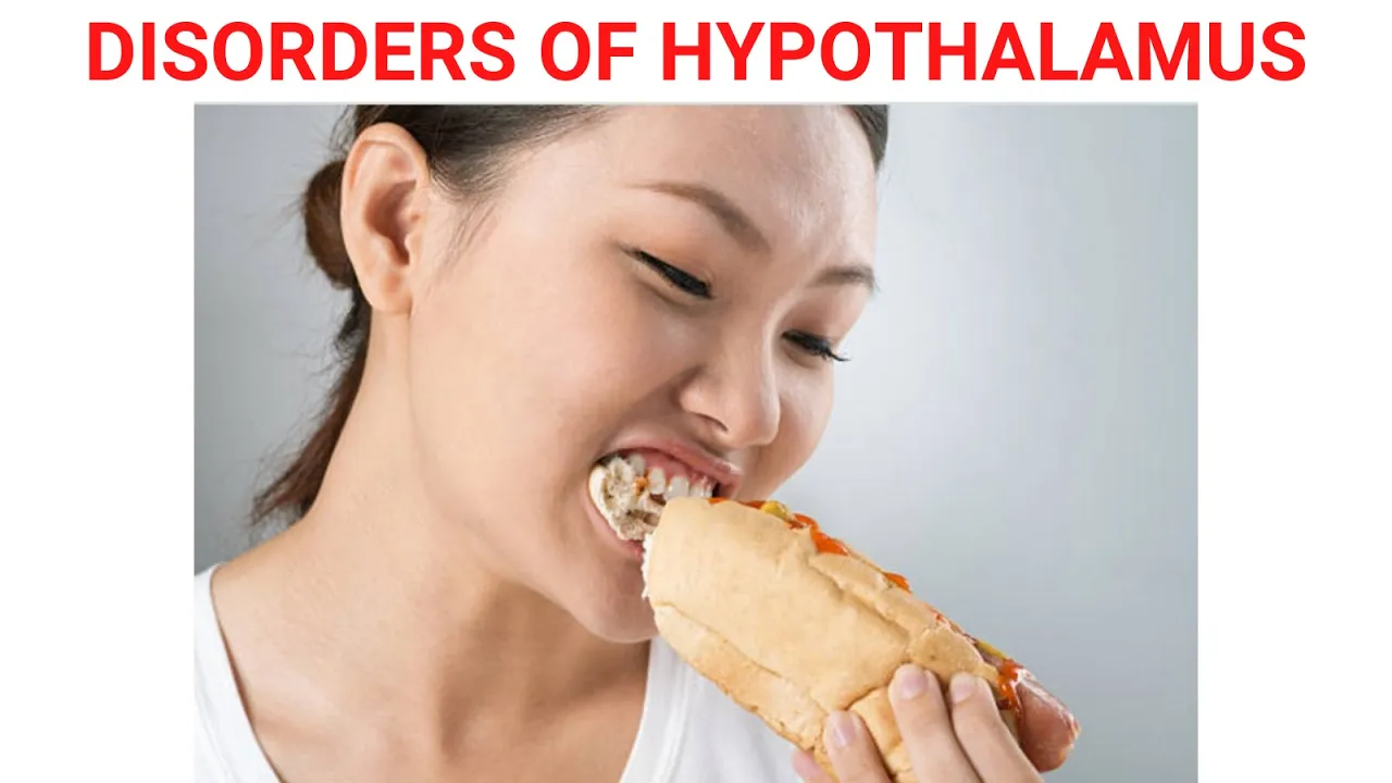Disorders of Hypothalamus