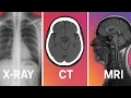 CT Scan vs MRI vs X-ray What s the Difference When Do You Need Each