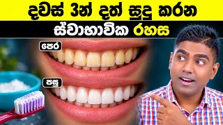 ඔබ දත් මදින විදිය සම්පූර්ණයෙන්ම වැරදියි! (මේකයි දත් කහ වෙන්න හේතුව)
