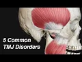 5 Common TMJ Disorders (Causing Ear Pain, Jaw Pain, Lockjaw, and/or Clicking/Popping)