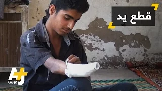 تنظيم الدولة يقطع يد مراهق بتهمة السرقة 