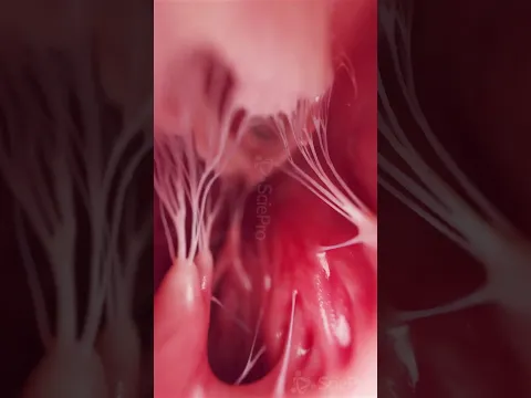The "Heartstrings" Are Real: Chordae Tendineae Up Close #Shorts #HeartAnatomy