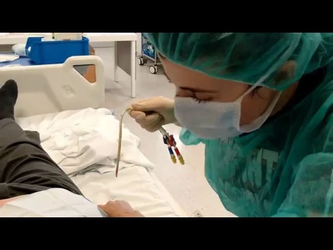 Download MP3 Técnica Astudillo: retirada de catéter venoso central tunelizado para Hemodiálisis