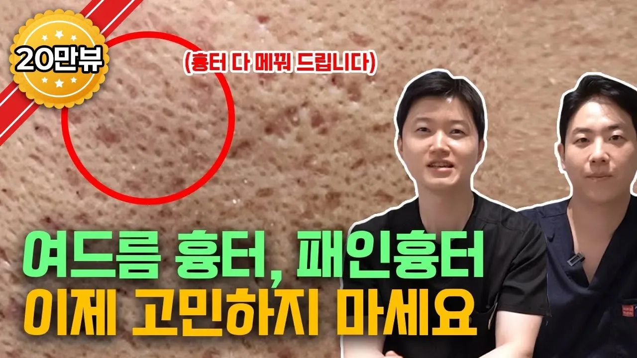 패인 여드름 흉터 없애는 가장 혁신적인 레이저가 나왔습니다 / 흉터치료 고민 끝