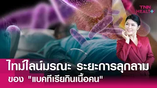 โรคนี้สามารถรักษาได้หรือไม่ และควรทำอย่างไรเมื่อมีอาการ?