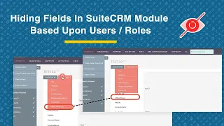 How to Hide Fields Sections Buttons and Other Data in SuiteCRM No-Code Solution