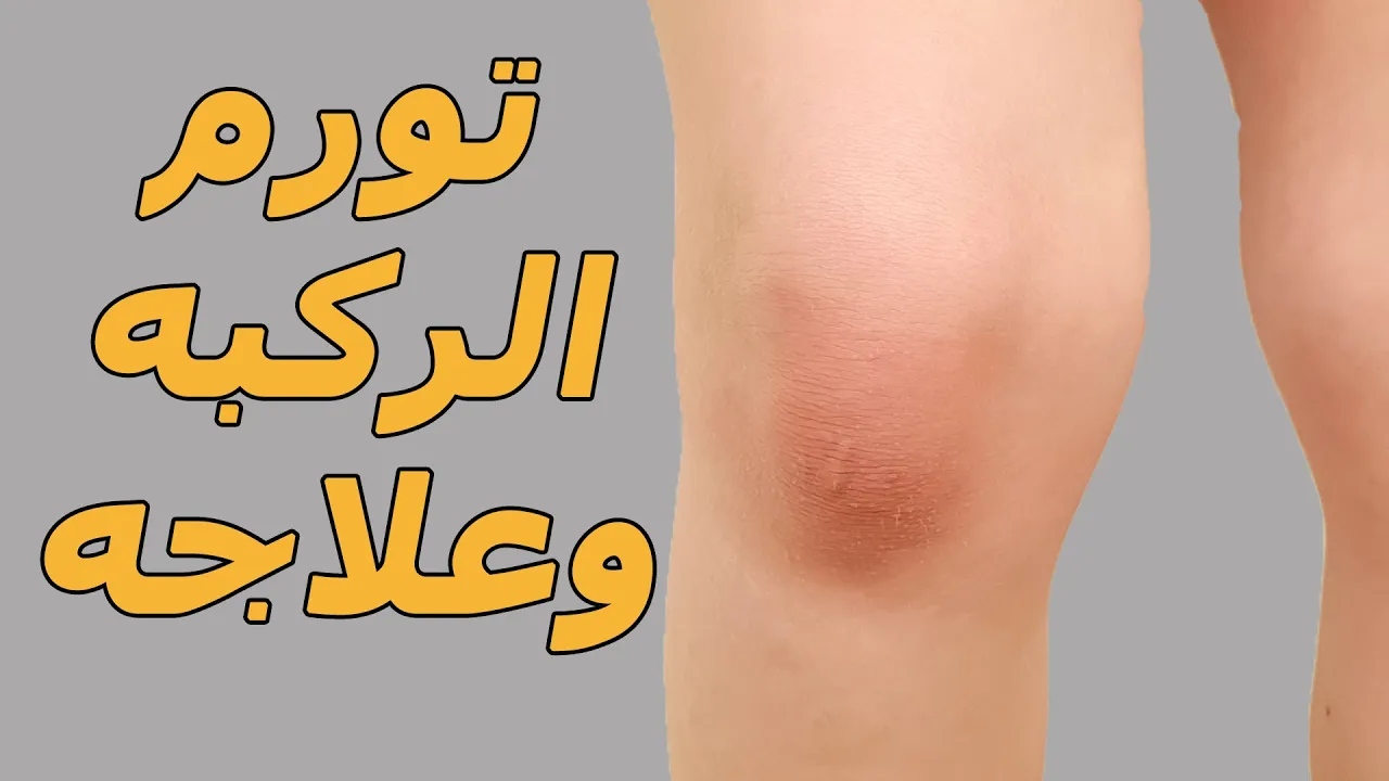 كيفية علاج خشونة الركبة | اسباب و أعراض خشونة الركبة |علاج خشونة المفاصل دكتور كريم رضوان